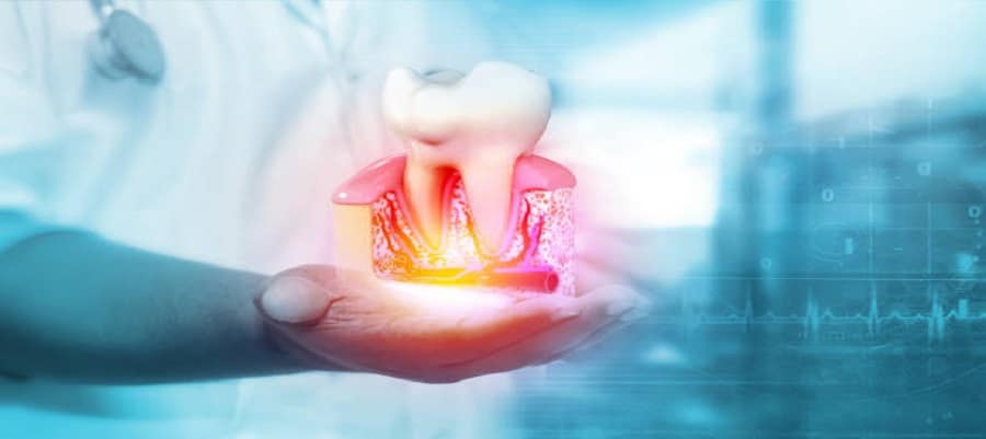 Things To Remember About Dental Implant Procedure 