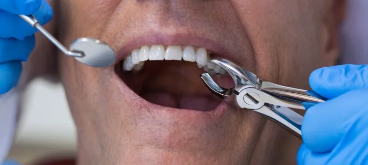 Does a Dental Implant Procedure Take