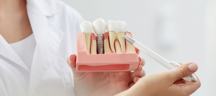 Is a loose dental implant an emergency