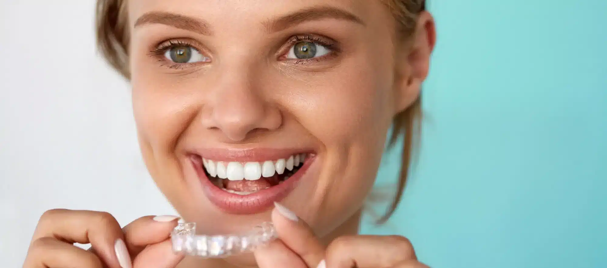 Timeline for Teeth Straightening with Dental Braces