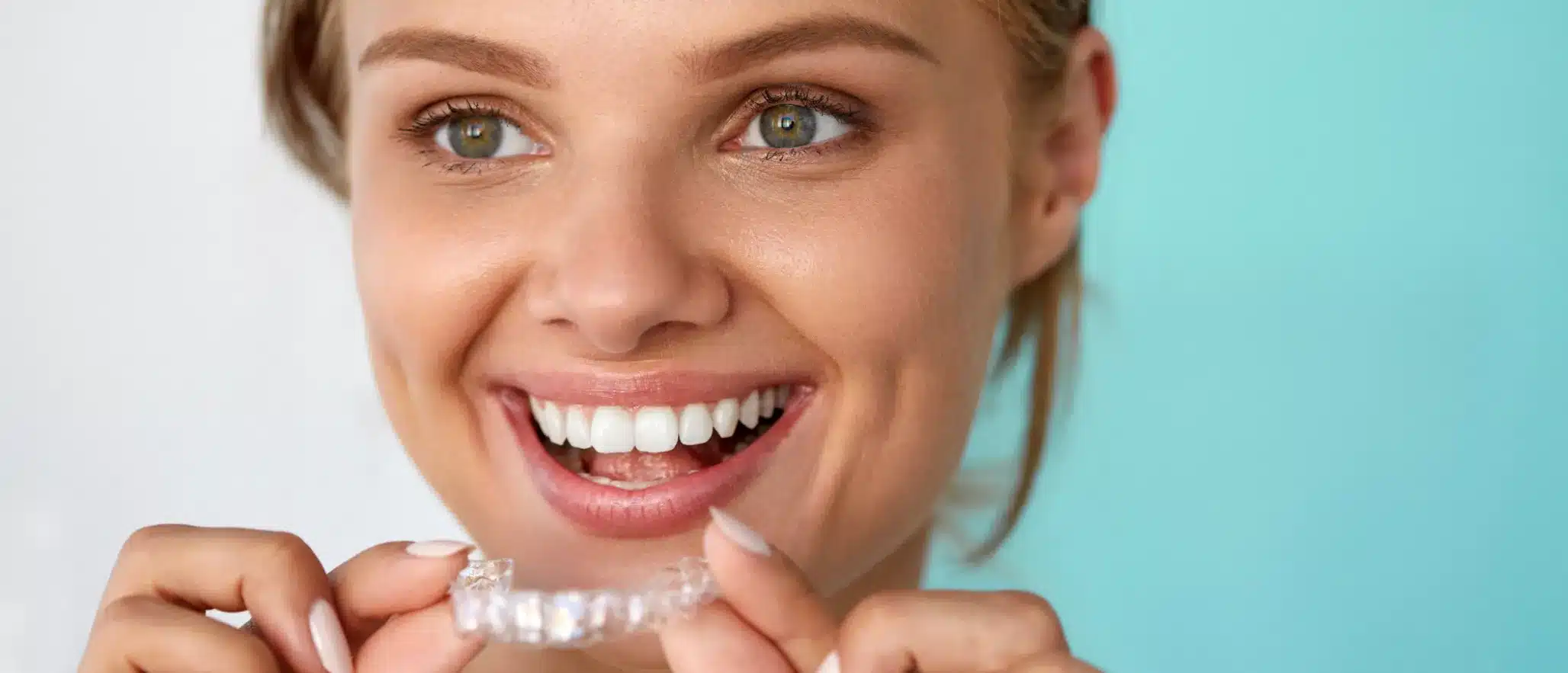 Timeline for Teeth Straightening with Dental Braces